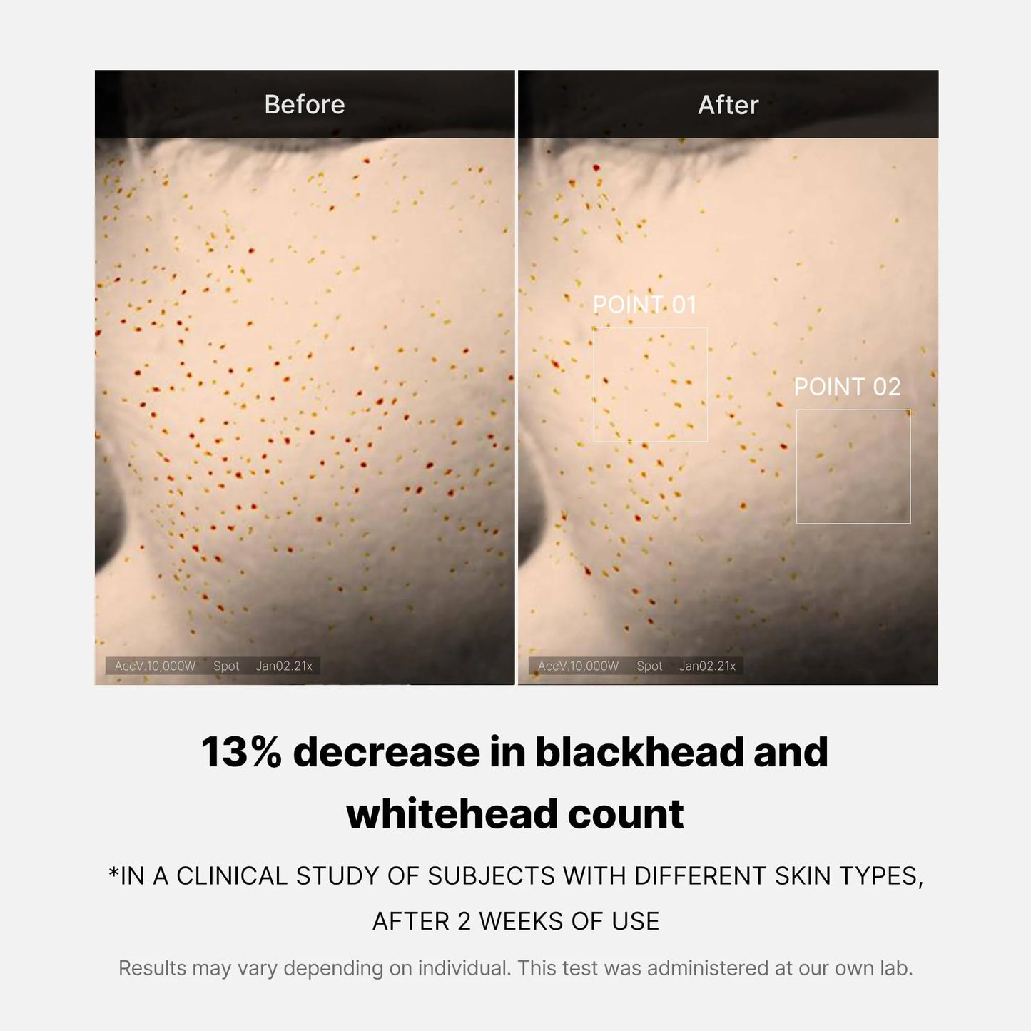 Medicube Zero Pore One Day Serum