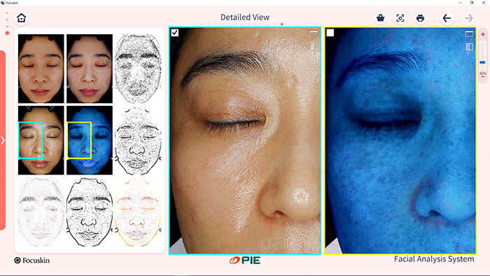 1:1 Personalised Skin analyses in store