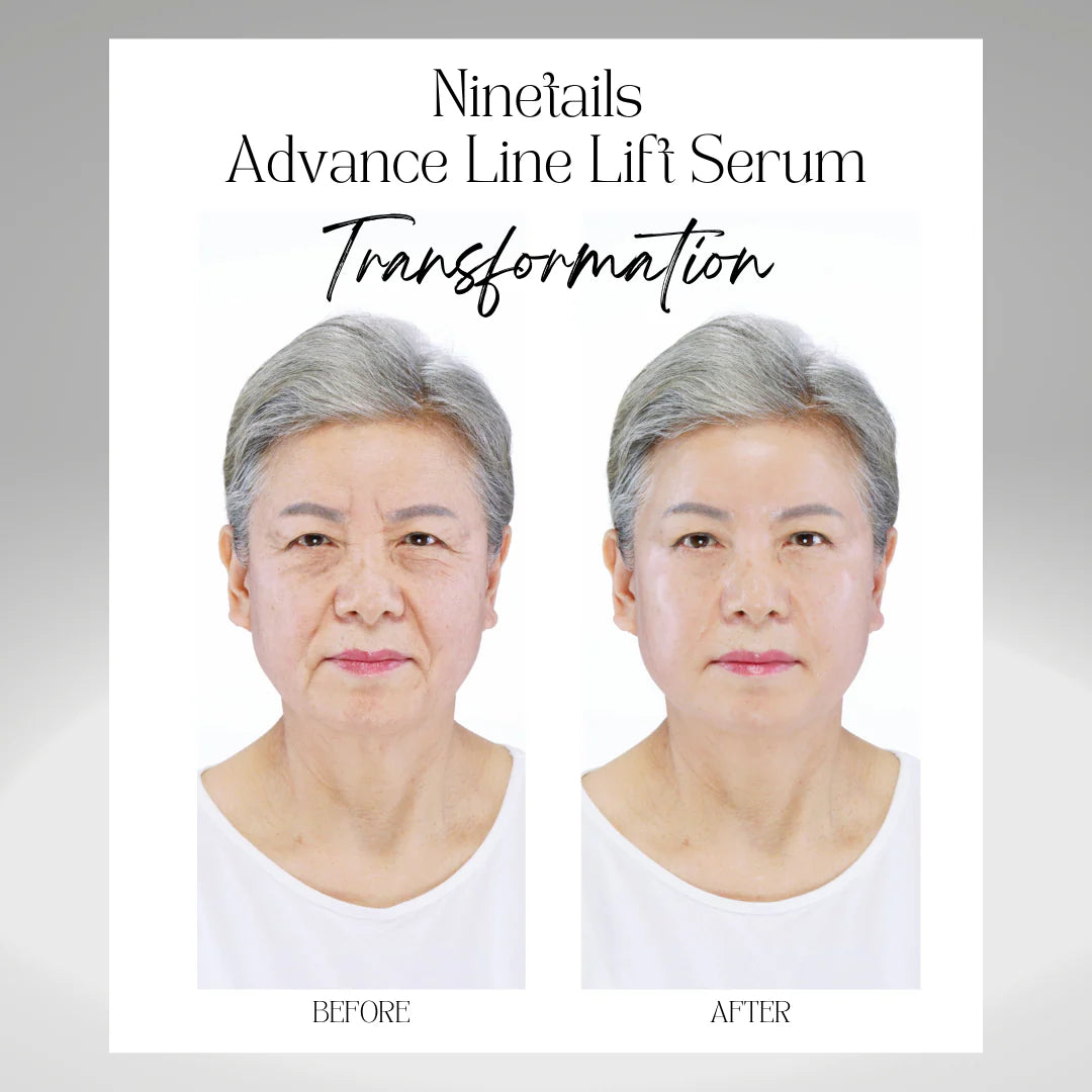 Nine Tails Advanced Line Lifting Serum
