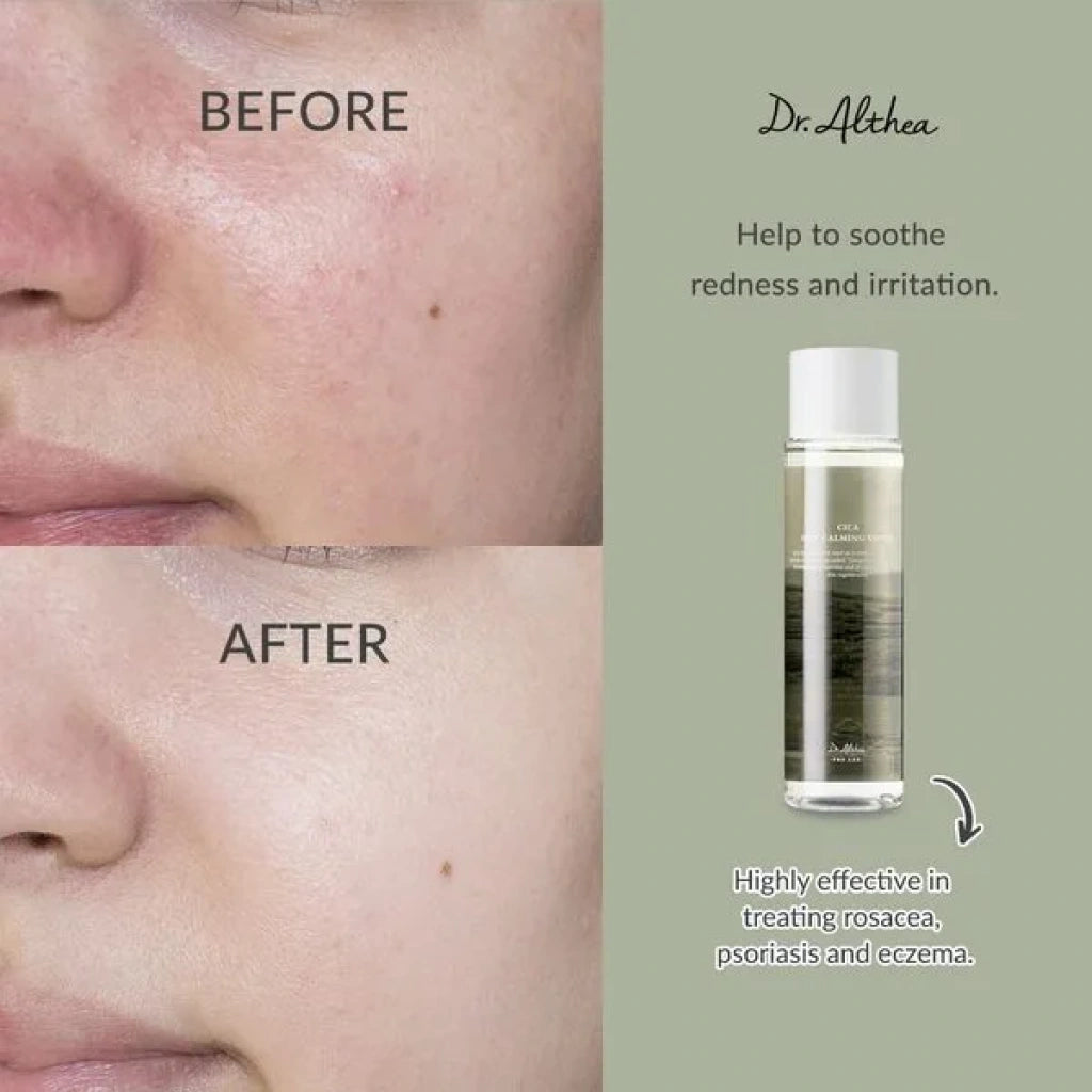 Dr. Althea soothing calming vegan toner