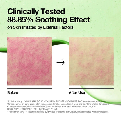 Anua Azelaic acid 10 + Hyaluron Soothing toner pad