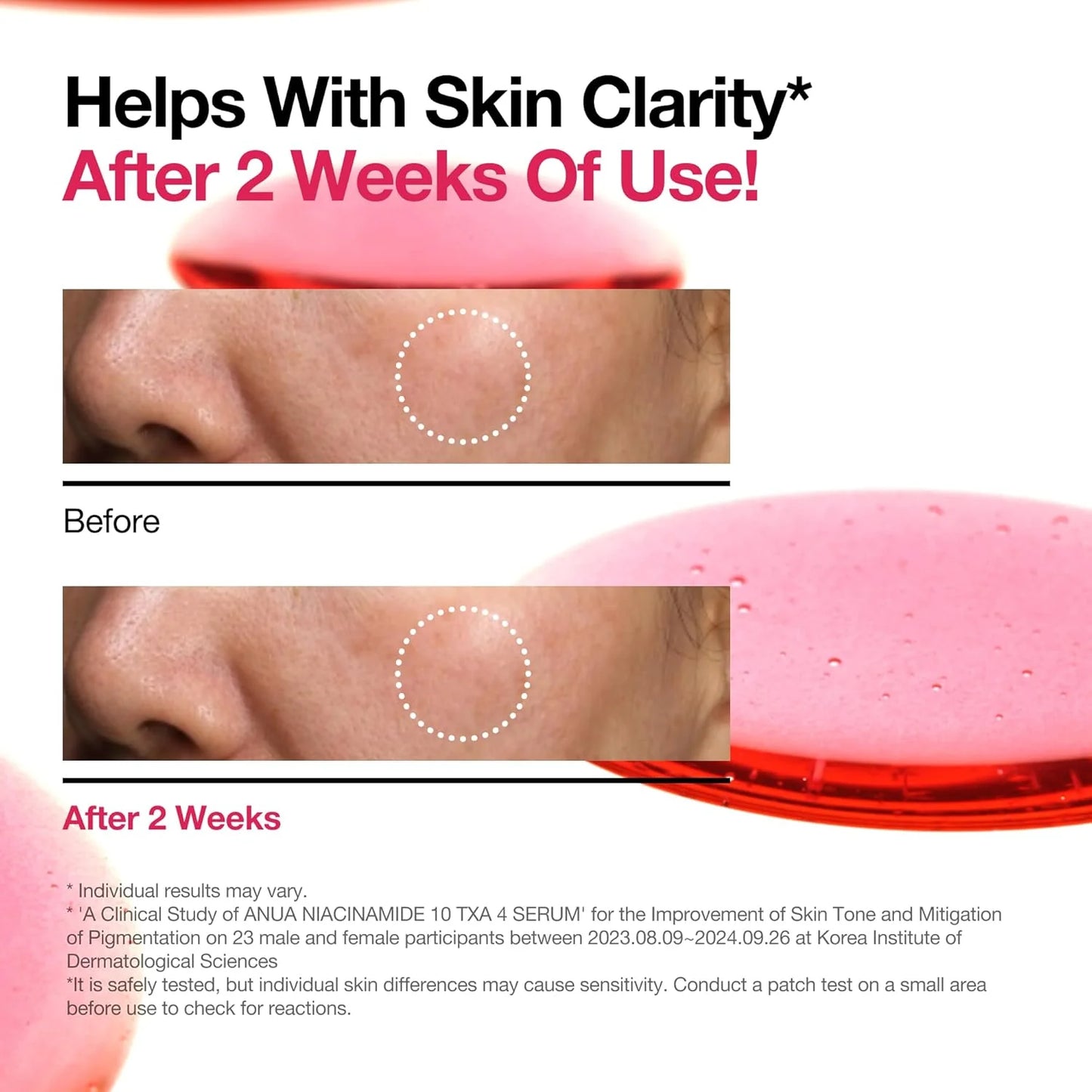 10% Niacinamide + 4% TXC-serum