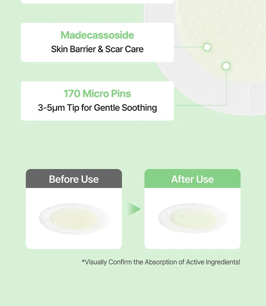 Ongredients AC Balancing PDRN Shot Patch