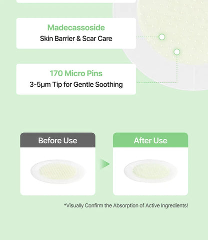 Ongredients AC Balancing PDRN Shot Patch